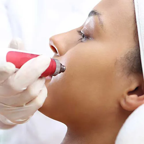 نمایندگی تعمیرات میکرونیدلینگ در کرج،اندیشه و غرب تهران مرکز هانی فیکس علی بغدادی