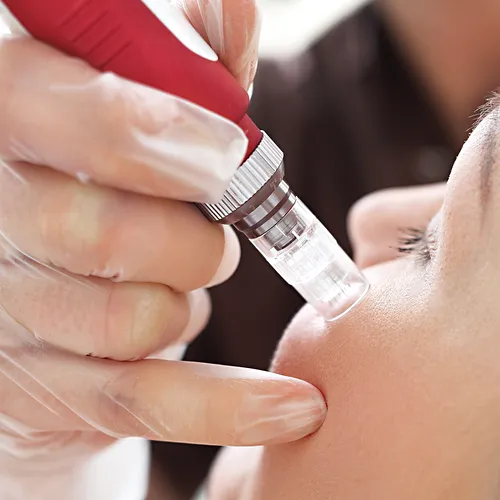 نمایندگی تعمیرات میکرودرم در کرج،اندیشه و غرب تهران مرکز هانی فیکس علی بغدادی